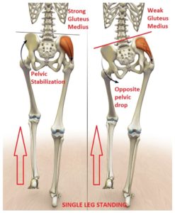 example of how improper movements can cause knee pain